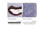 Immunohistochemistry analysis in human epididymis and lymph node tissues using Anti-ECM1 antibody. Corresponding ECM1 RNA-seq data are presented for the same tissues.