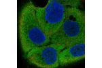 Immunofluorescent staining of human cell line HaCaT shows localization to cytosol.