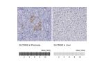 Immunohistochemistry analysis in human pancreas and liver tissues using Anti-SLC30A8 antibody. Corresponding SLC30A8 RNA-seq data are presented for the same tissues.