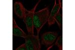 Immunofluorescent staining of human cell line SH-SY5Y shows localization to nucleoplasm.