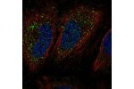 Immunofluorescent staining of human cell line HeLa shows localization to vesicles.