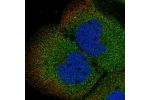 Immunofluorescent staining of human cell line A-431 shows localization to cytosol.