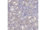Immunohistochemical staining of human kidney shows weak cytoplasmic positivity in cells in tubules.