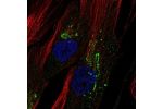 Immunofluorescent staining of human cell line ASC TERT1 shows localization to the Golgi apparatus.