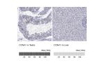 Immunohistochemistry analysis in human testis and liver tissues using Anti-CCNA1 antibody. Corresponding CCNA1 RNA-seq data are presented for the same tissues.