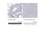 Immunohistochemistry analysis in human testis and skeletal muscle tissues using Anti-C11orf63 antibody. Corresponding C11orf63 RNA-seq data are presented for the same tissues.