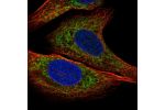 Immunofluorescent staining of human cell line U-2 OS shows localization to endoplasmic reticulum.