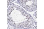 Immunohistochemical staining of human testis shows weak nuclear positivity in cells in seminiferous ducts.