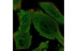 Immunofluorescent staining of human cell line PC-3 shows localization to nucleoplasm, nuclear bodies & cytosol.