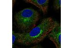 Immunofluorescent staining of human cell line A549 shows localization to endoplasmic reticulum & the Golgi apparatus.