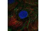 Immunofluorescent staining of human cell line A-431 shows localization to intermediate filaments.