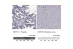 Immunohistochemistry analysis in human prostate and cerebral cortex tissues using HPA078571 antibody. Corresponding NKX3-1 RNA-seq data are presented for the same tissues.