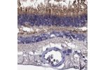 Immunohistochemical staining of human retina shows strong cytoplasmic positivity in photoreceptor cells.
