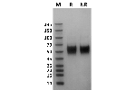 Human Fc gamma RIIIa / CD16a (176F) protein on Coomassie Blue stained SDS-PAGE under non-reducing (NR) and reducing (R) conditions. The purity of the protein is greater than 95%.