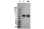 Human Fc gamma RIIIa / CD16a (176V) protein on Coomassie Blue stained SDS-PAGE under non-reducing (NR) and reducing (R) conditions. The purity of the protein is greater than 95%.