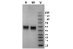 Human Fc gamma RIIIb / CD16b (NA1) protein on Coomassie Blue stained SDS-PAGE under non-reducing (NR) and reducing (R) conditions. The purity of the protein is greater than 95%.