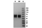 Human Fc gamma RIIIb / CD16b (NA2) protein on Coomassie Blue stained SDS-PAGE under non-reducing (NR) and reducing (R) conditions. The purity of the protein is greater than 95%.