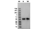 Human Fc gamma RIIa / CD32a (167H) protein on Coomassie Blue stained SDS-PAGE under non-reducing (NR) and reducing (R) conditions. The purity of the protein is greater than 95%.