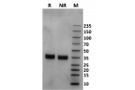 Human Fc gamma RIIa / CD32a (167R) protein on Coomassie Blue stained SDS-PAGE under non-reducing (NR) and reducing (R) conditions. The purity of the protein is greater than 95%.