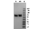 Human Fc gamma RI / CD64 protein on Coomassie Blue stained SDS-PAGE under non-reducing (NR) and reducing (R) conditions. The purity of the protein is greater than 95%.