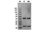 Human FcRn on Coomassie Blue stained SDS-PAGE under non-reducing (NR) and reducing (R) conditions. The upper band is the FCGRT 'heavy' chain and the lower band is the B2M 'light' chain. The purity of the protein is greater than 95%.