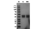 Marmoset Fc gamma RIIb / CD32b on Coomassie Blue stained SDS-PAGE under non-reducing (NR) and reducing (R) conditions. The purity of the protein is greater than 95%.