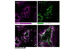 MolBoolean analysis of the interaction between ACE2 (cat. AMAb91259, magenta) and TMPRSS2 (cat. HPA035787, green) in human kidney, showing the relative quantification of free versus interacting protein fractions, indicated by the detection of rolling circ