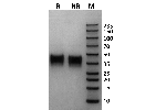 Mouse Fc gamma RIIb / CD32b on Coomassie Blue stained SDS-PAGE under non-reducing (NR) and reducing (R) conditions. The purity of the protein is greater than 95%.