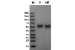 Mouse Fc gamma RI / CD64 on Coomassie Blue stained SDS-PAGE under non-reducing (NR) and reducing (R) conditions. The purity of the protein is greater than 95%.
