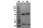 Mouse FcRn on Coomassie Blue stained SDS-PAGE under non-reducing (NR) and reducing (R) conditions. The purity of the protein is greater than 95%.