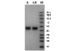 Pig Fc gamma RIIa / CD32a on Coomassie Blue stained SDS-PAGE under non-reducing (NR) and reducing (R) conditions. The purity of the protein is greater than 95%.