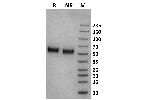 Pig Fc gamma RI / CD64 on Coomassie Blue stained SDS-PAGE under non-reducing (NR) and reducing (R) conditions. The purity of the protein is greater than 95%.
