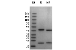 Pig FcRn on Coomassie Blue stained SDS-PAGE under non-reducing (NR) and reducing (R) conditions. The upper band is the FCGRT 'heavy' chain and the lower band is the B2M 'light' chain. The purity of the protein is greater than 95%.