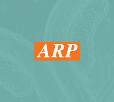 Anti-C-reactive protein (CRP) Monoclonal Antibody