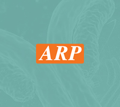 Anti-C-Reactive Protein (CRP) Gamma Polyclonal Antibody
